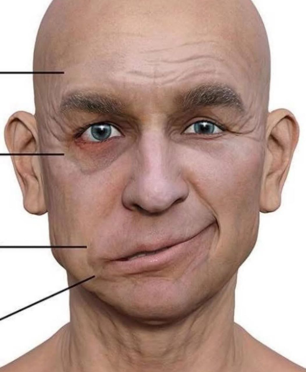 Let’s Talk about STROKE; Professions at Risk, Symptoms, Causes and Some Remedies